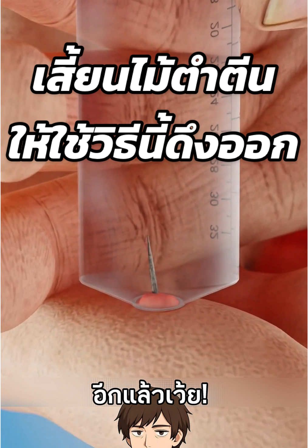 เสี้ยนไม้ตำเหรอ? ใช้แบบนี้ดึงโคตรฟิน!😰 #สาระความรู้ #ความรู้รอบตัว #เรื่องเล่า #ฟีดดดシ #เรื่องจริง Cr. Zack D Flims