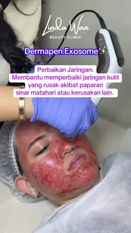 Permasalahan bopeng, tekstur kulit tidak merata? Bekas jerawat? Kerutan halus👌✨ 