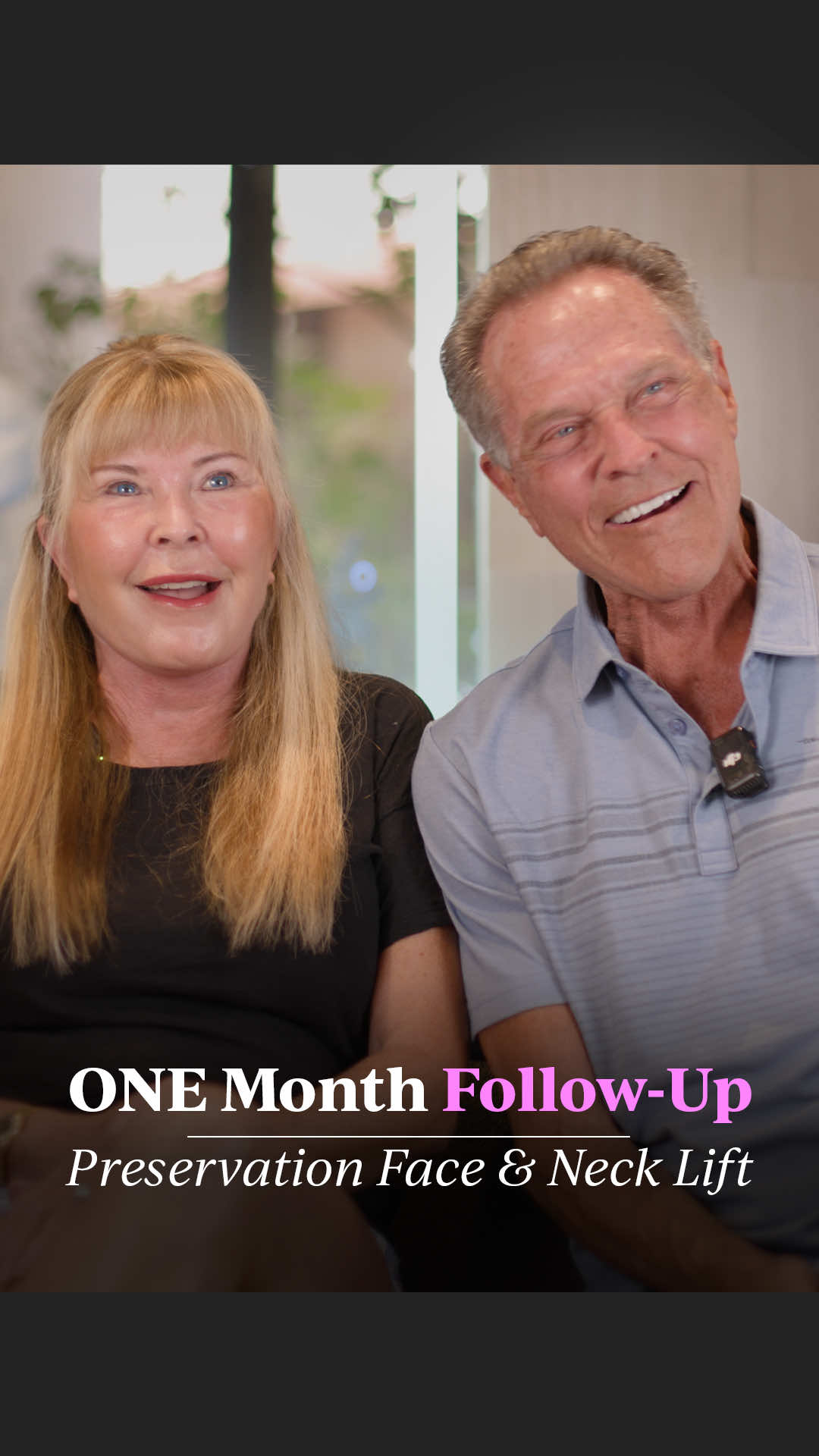 𝗢𝗻𝗲 𝗠𝗼𝗻𝘁𝗵 𝗙𝗼𝗹𝗹𝗼𝘄-𝗨𝗽 - 𝗖𝗼𝘂𝗽𝗹𝗲𝘀 𝗘𝗱𝗶𝘁𝗶𝗼𝗻 We decided to try something new with Jerry and Lisa for this one-month post-op interview. For a longer extended version, go to my YouTube Channel (Link in My Stories) Jerry received the following treatments under twilight sedation without the need for general anesthesia: ✅ Preservation Deep Plane Face and Neck Platsymaplasty ✅ Deep Neck Contouring ✅ Botox to Forehead and Crow’s Feet Lisa received the following treatments also under twilight sedation without the need for general anesthesia: ✅ Preservation Deep Plane Face and Neck Lift ✅ Temporal Brow Lift ✅ Fractionated CO2 Laser If you’re interested in learning more about my approach to facial rejuvenation, my Patient Care Coordinators, Heather and Lisa, are available at 949-776-4101. They’re happy to answer your questions, guide you through the process, and help schedule your consultation when you’re ready.