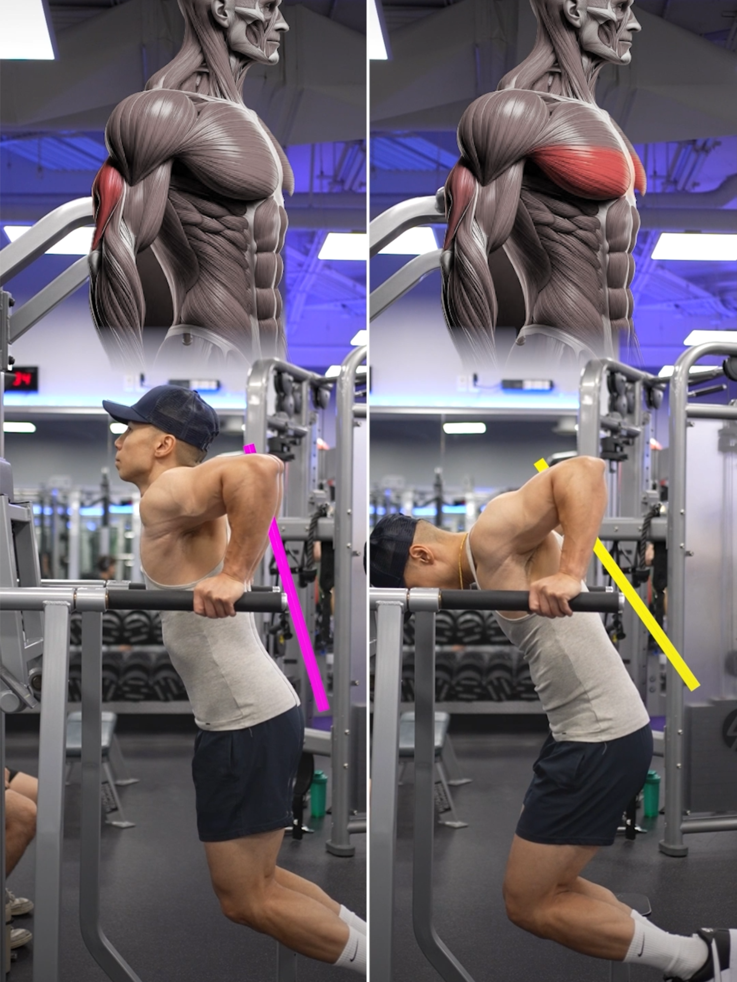 Size & Shred Training program  👉🏻 deltabolic.com Dips – KNOW THE DIFFERENCE! Upright body → Focuses on the triceps Leaning forward → Emphasizes the lower chest (still works triceps) #dips