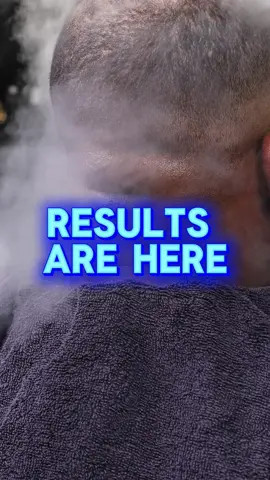 Changing scalps daily!! NEED THIS SERVICE? WANT TO LEARN THIS SERVICE? DM TODAY!!! 💪🏾💪🏾#akn #treatement #results #charlottenc #dm 