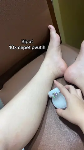 #biput #biputoriginal #bibitpemutih 