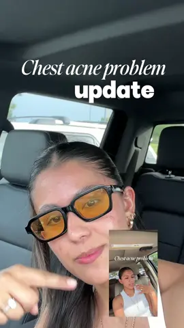 Ok amigas…update chest acne & trying new products 🫰🏼 Estuvo usando el jabón de barra de @Good Molecules y wow!! Si note la diferencia ✨ No es magia, pero la constancia + estos productos = cambios reales Les gustaría saber más tips? #latinalifestyle #skincareupdate #goodmolecules #acnesolution #skincare  
