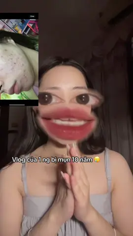 Muốn chia sẻ tới các đồng mụn 1 chút, kiên trì lên rồi mn sẽ vượt qua dc