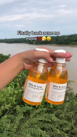 ang saya naman 😭🫶 #quarxery #quarxerymiteandacnebodaywash #bodywash #backacnesolution #fyppppppppppppppppppppppp 