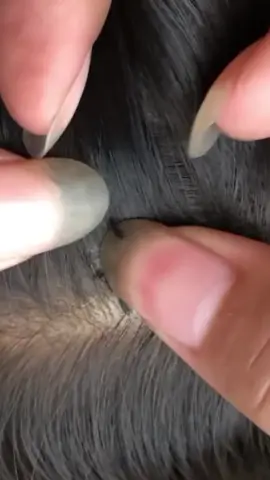 😱😱😱 #lice #omg 