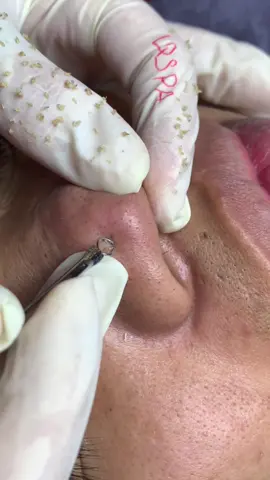 Dữ dội #chamsocdaseo#chamsocda#chamsocdamun#chamsocdanam#tanbinh          