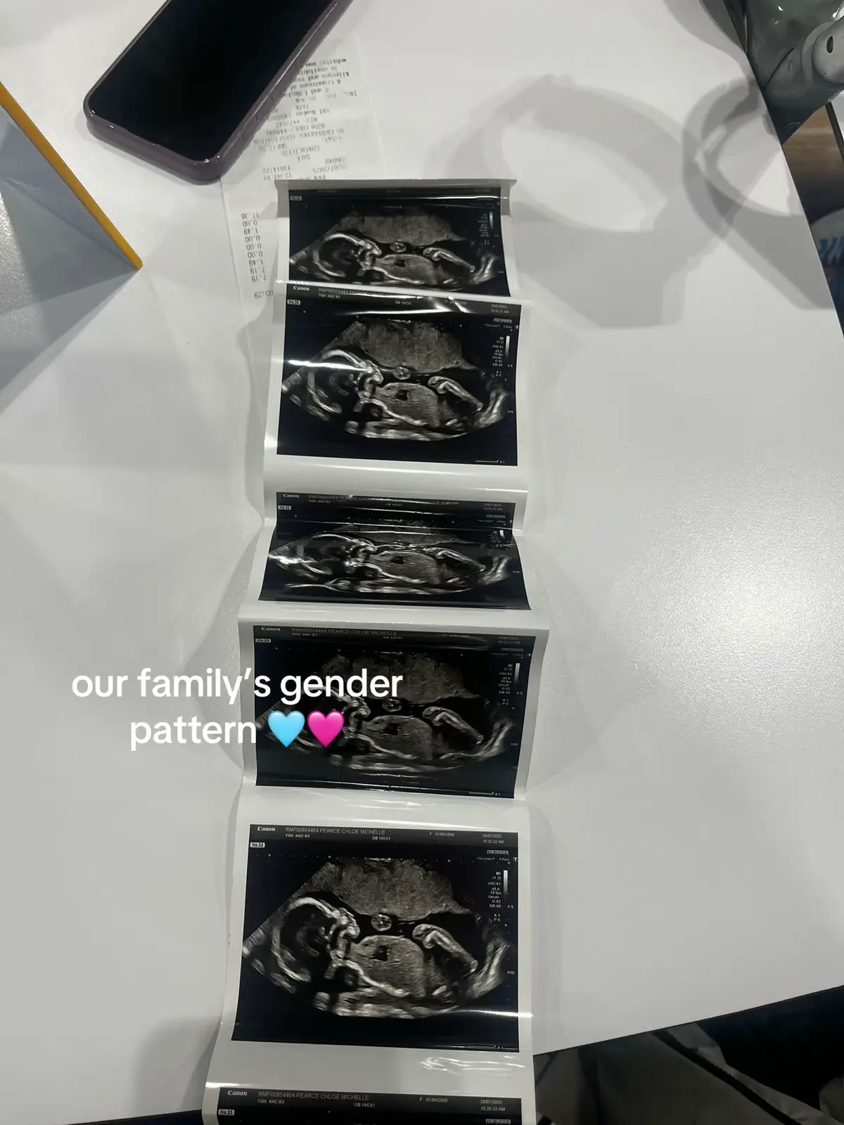 this trend is so cute #fyp #babygender #family