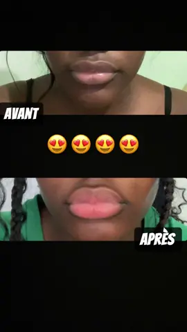 Vos lèvres mon combat 😍😍  Pour commander retrouver le lien en bio 🌐  Thesisterseyes.fr #levresrose #pourtoii #beaute #💋💋💋 