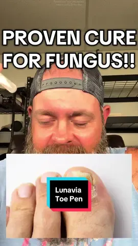 Informed choices lead to effective results. Let’s talk about the Lunavia Antifungal Pen. This targeted treatment uses Undecylenic Acid, a powerful FDA-approved ingredient proven to cure foot fungus. Its precise, mess-free applicator makes targeted application simple and supports a consistent treatment routine. A proven and effective solution for athlete’s foot, ringworm, and jock itch. #Lunavia #FootFungus #Fungus #TikTokShopCreatorPicks #TikTokShopRestock 