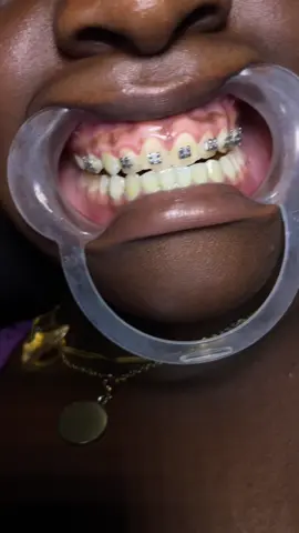 #jamaicantiktok🇯🇲viral #blowup #viral #jamaicanbarber #fyppppppppppppppppppppppp 