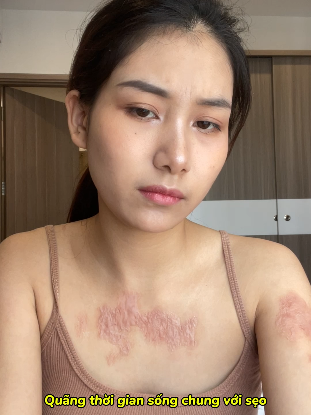 Tôi đã đối mặt và trải qua sự tự ti này, chỉ cần kiên trì các bạn chắc chắn sẽ làm được như tôi