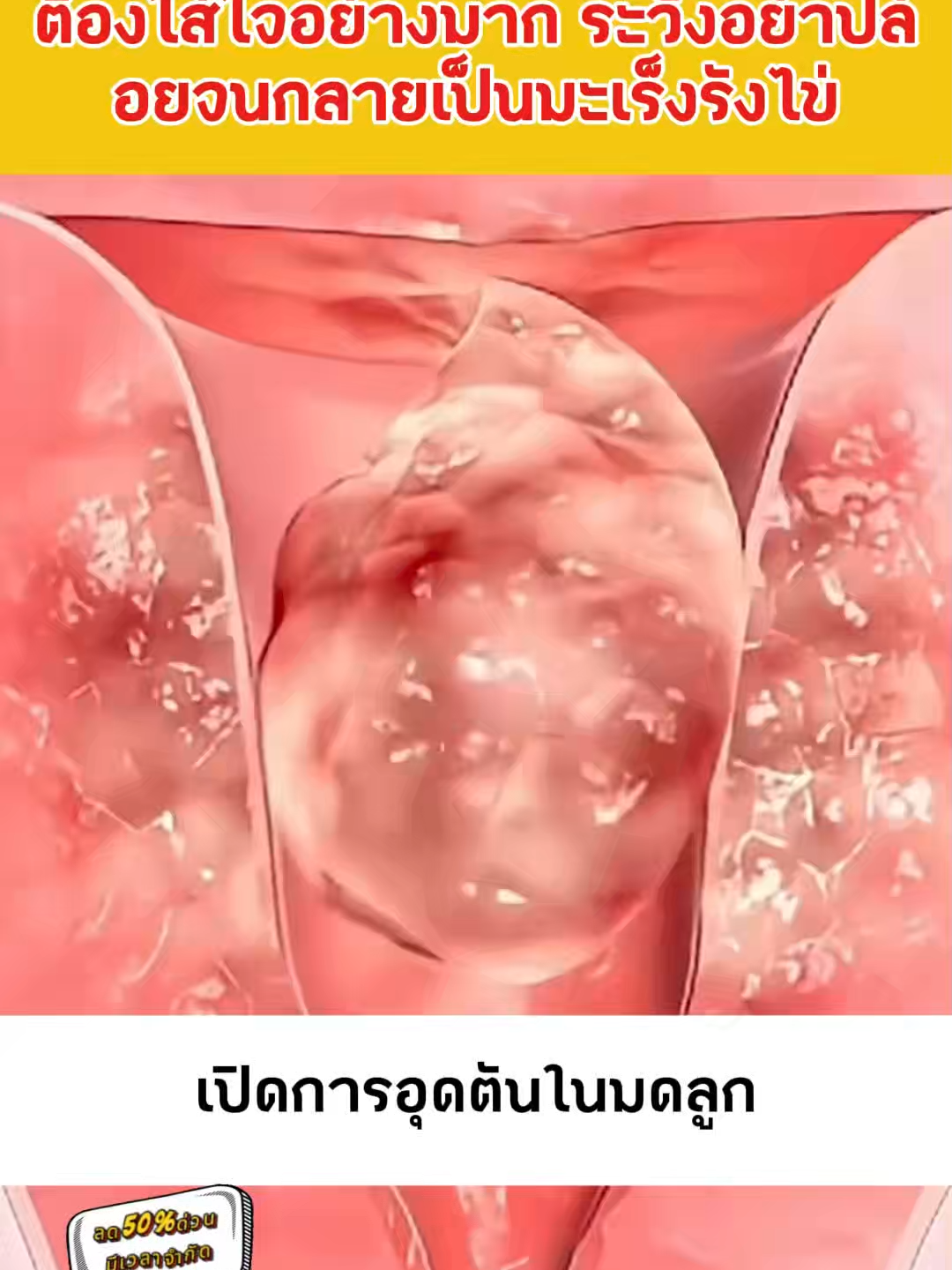 50 % ส่วนลดสำหรับเวลา จำกัด มีเพียง 200 รายการเท่านั้น คลิก ที่ลิงก์ด้านล่าง และซื้อทันที ไม่มีเอฟเฟกต์การคืนเงินเต็มจํานวน 10 รายการ ที่แนะนำ 9 การปรับปรุงเชื่อเรา #อากาศเย็น #มดลูกหย่อน