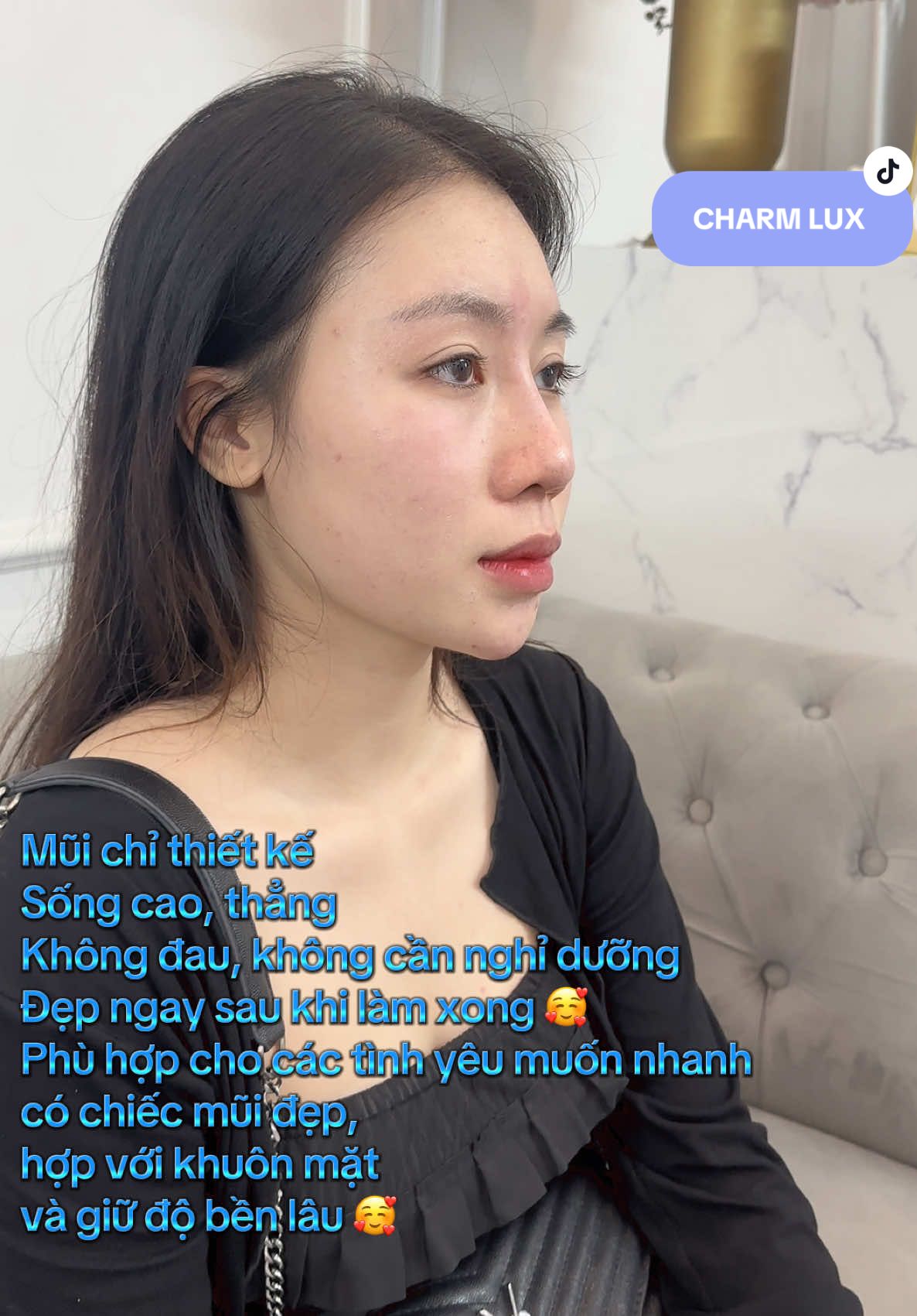 Mũi Chỉ PCL thiết kế, sợi chỉ cao cấp nhất hiện  nay. Anh chê mũi tẹt để quay lại với nyc mới làm mũi cao 😁 vậy là muốn quay lại để kiếp sau #xh #xhtiktok #fbyツ #sơntùngmtp #thịnhhành 