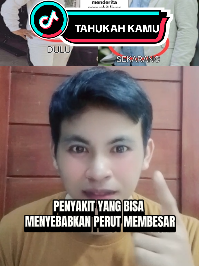 Diduga sule menderita penyakit liver, terlihat ciri-cirinya dari perutnya yang membesar#tahukahkamu#penyakitliver#sule#foryou#fyp 