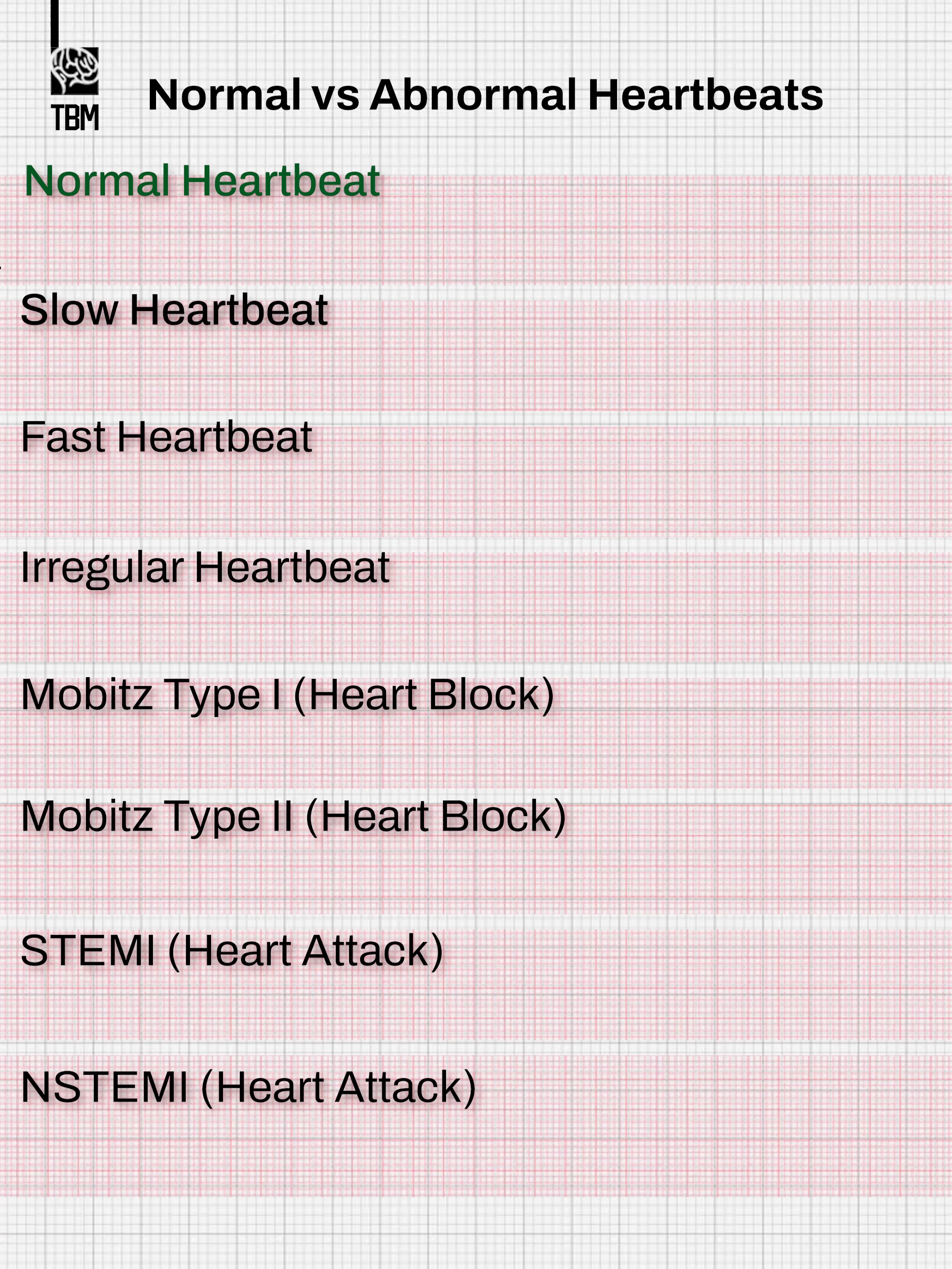 Normal VS Abnormal Heartbeats - This animation shows examples of different heartbeat patterns — from normal rhythm to irregular beats, heart blocks, and signs of heart attack. It is designed for educational and illustrative purposes only. Please note that actual ECG patterns can vary widely, and accurate interpretation requires medical training and expertise. Do not use this video for medical diagnosis or self-assessment. Always consult a qualified healthcare professional if you have concerns about your heart health.#viraltiktok #foryou #viral #foryoupage #viralvideo🔥 #fypシ゚ #fyp #heartbeat #EKG