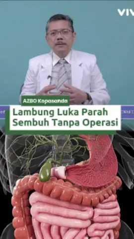 Lambung luka parah dan cara sembuh tanpa operasi #lambung #gerd 