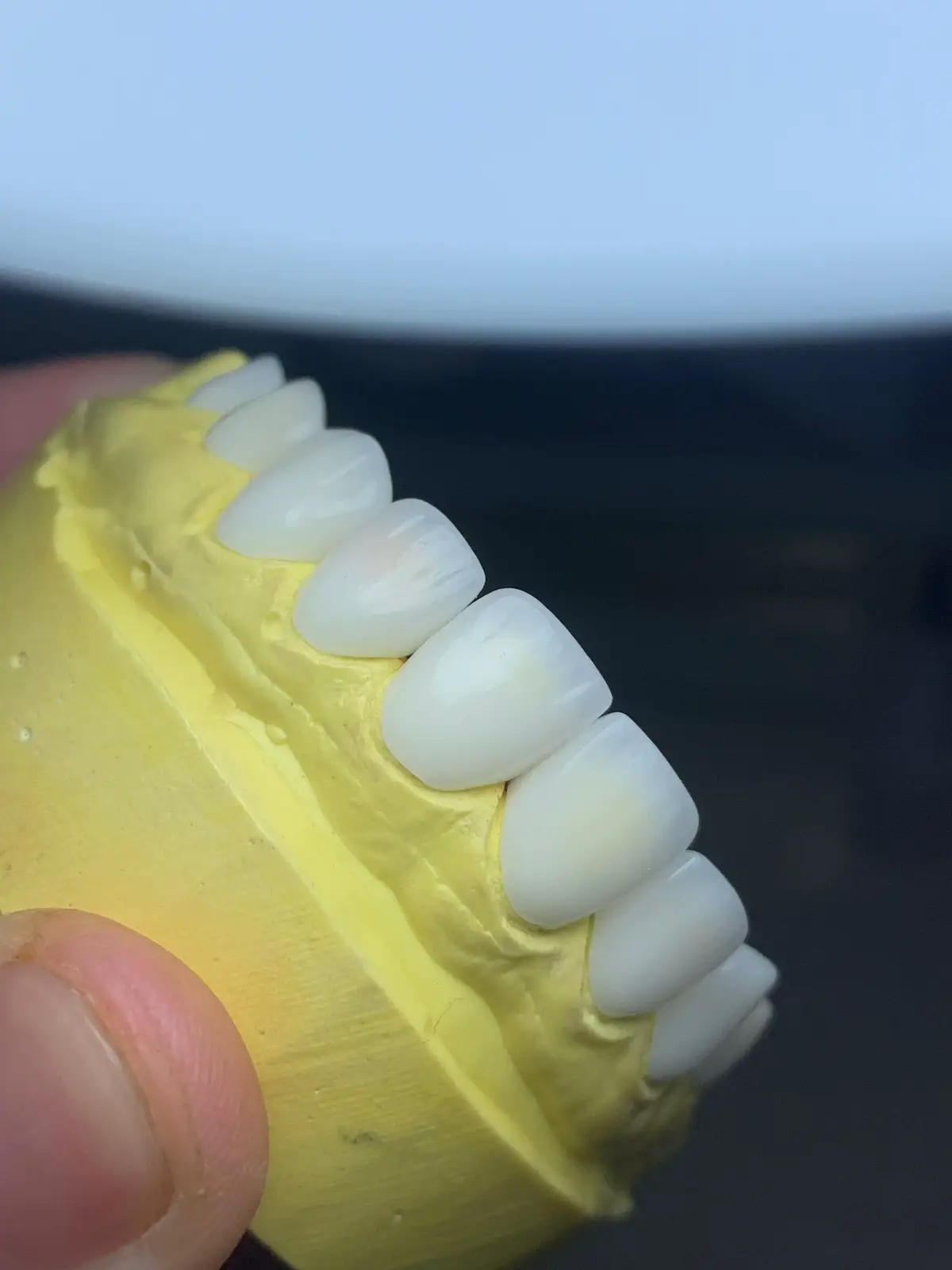 #dentallab #dentist #xuhuong #smile #dentallaboratory 