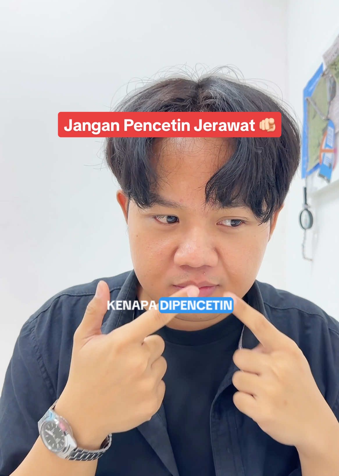 Siapa yang suka mencetin jerawat kaya gini? 🫵🏻😩 Pliss yaa, jangan dipencetin jerawatnya, karena bisa nimbulin masalah baru di kulit kamu salah satunya bopeng 😭 Kalo jerawatan, mending dirawat dengan sepenuh hati biar jerawatnya gak makin meradang.. Misalnya rutin minum zinc biar jerawatnya cepet sembuh, zinc juga bisa bantu kurangin produksi sebum di kulit, terus anti radang dan inflamasi 🥰 Mumpung besok Special Event 9.9 kamu bisa beli zinc Tomo Kenko, lagi ada free gift acne patch tiap pembelian zinc 😍 Yukkk jangan sampe ketinggalan, sekalian restock vitamin lainnya juga yahh ✨ #tomokenko #vitamindtomokenko #doubledate #supershoppingday #promo 