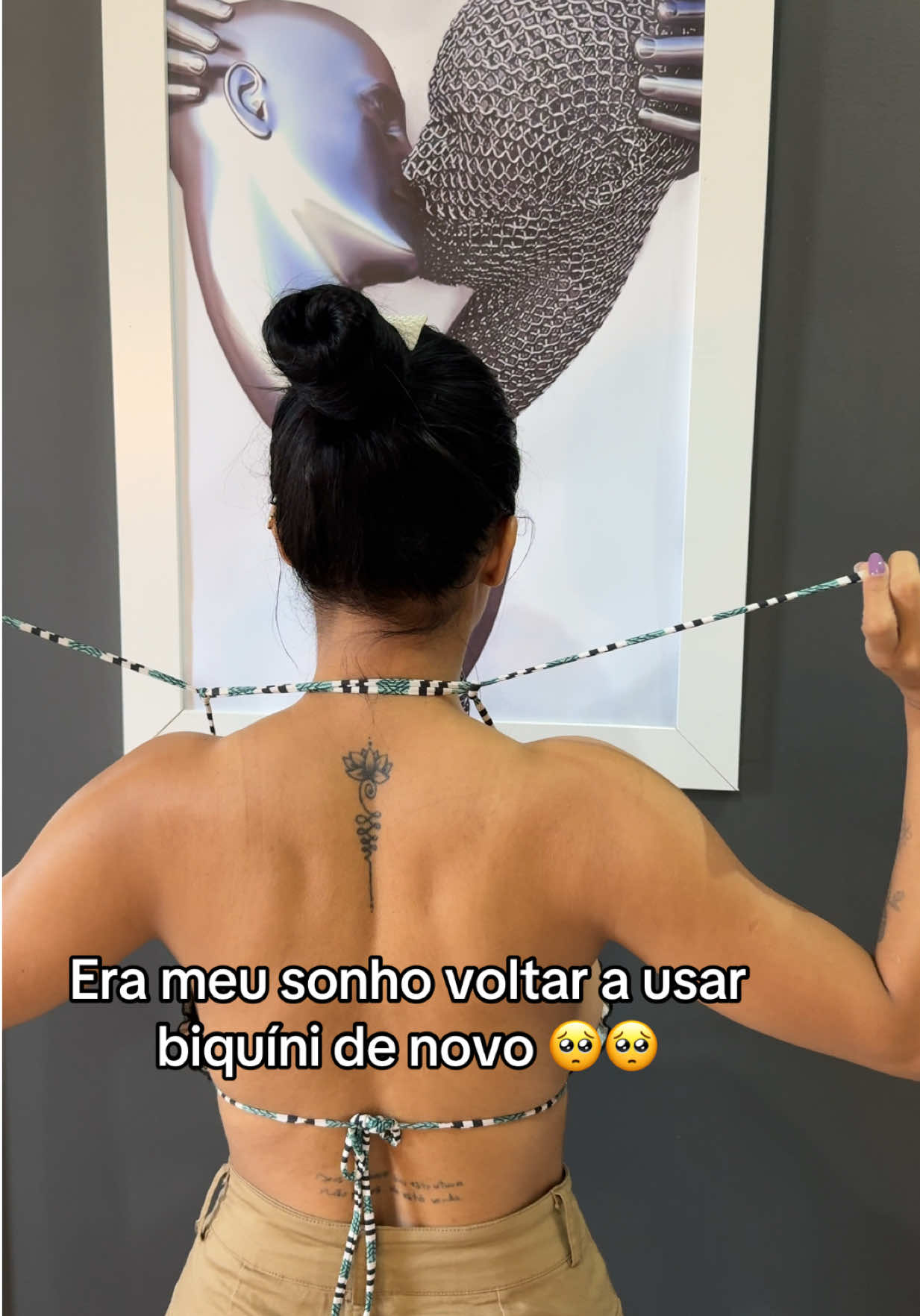 Era meu sonho 🥺 #lipedema #estrias #celulite #popozuda #flacidez 