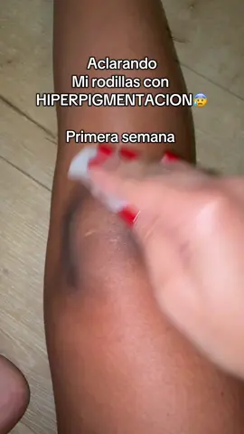 Finalmente conseguí algo que me ayuda con mi hiperpigmentacion 🥹🥹🥹♥️ 