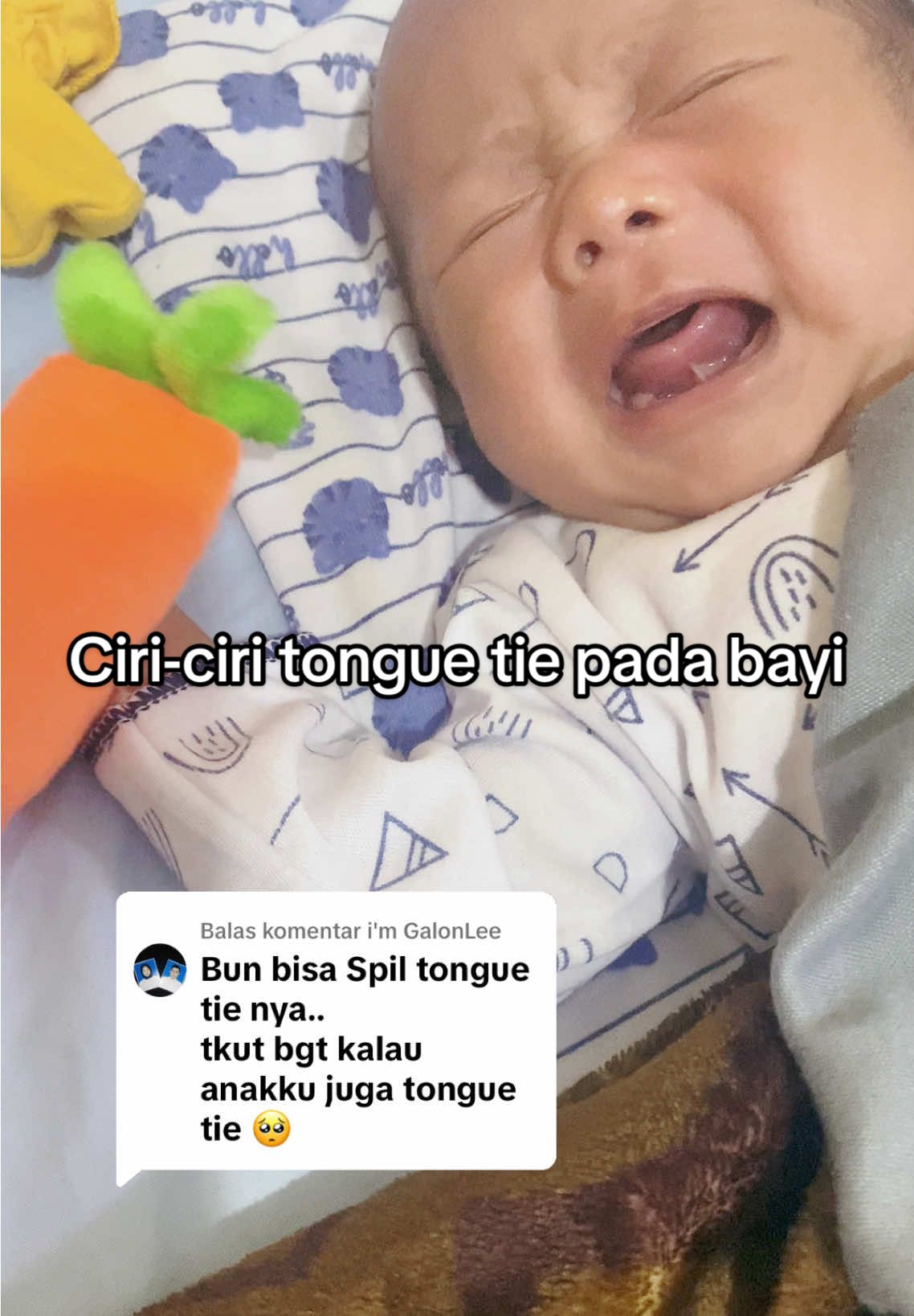 Membalas @i'm GalonLee ciri-cirinya : ada daging tipis di bawah lidah, lidah tidak bisa menjulur ke  area luar mulut, daya hisap  kurang dan saat dbf sering lepas