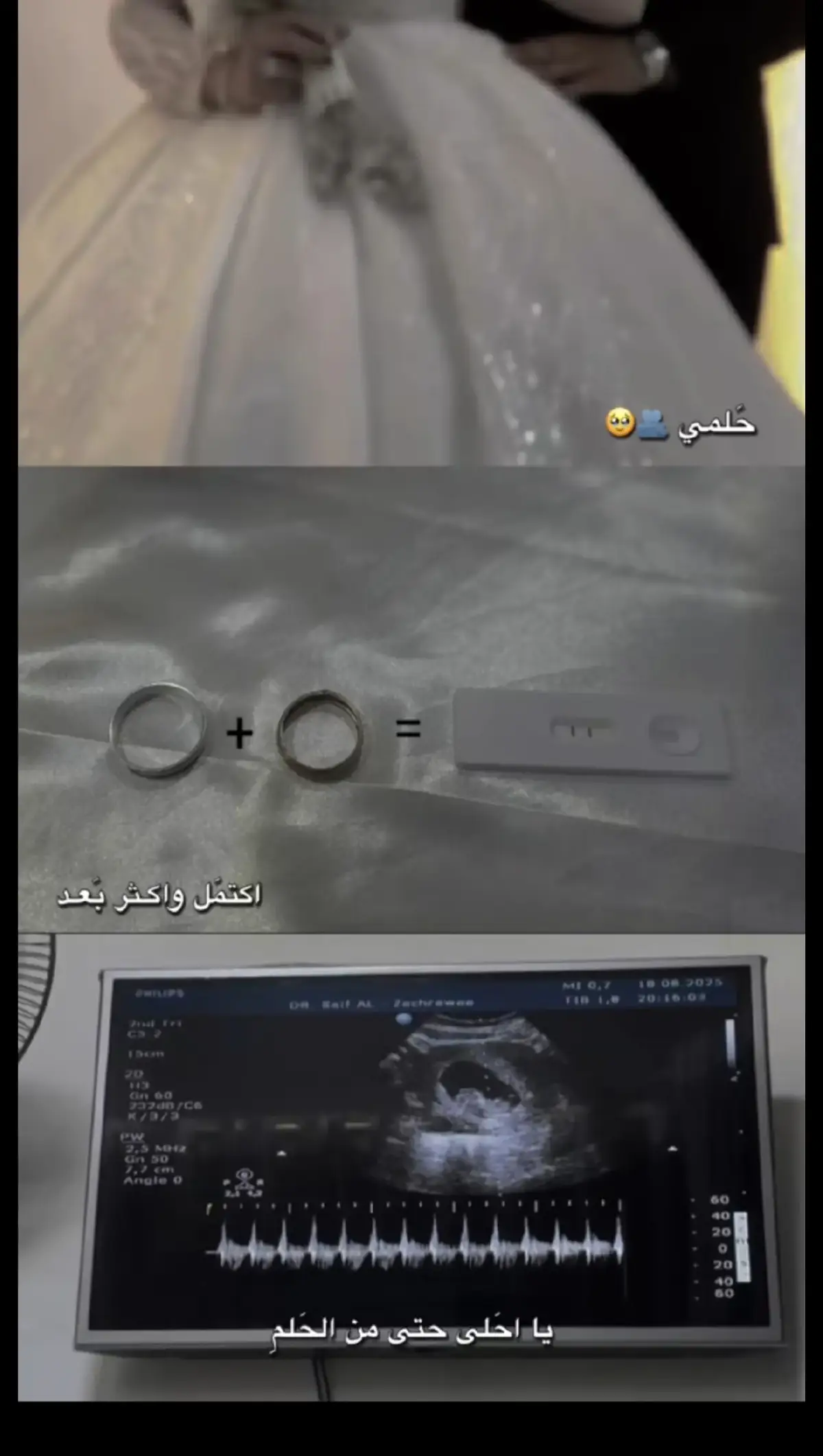 #فرحتي_الاولى🤍 #الحمدلله_دائماً_وابداً  #الله_يرزقني_ويرزقكم_الذريه_الصالحه🥀🙏🥺 