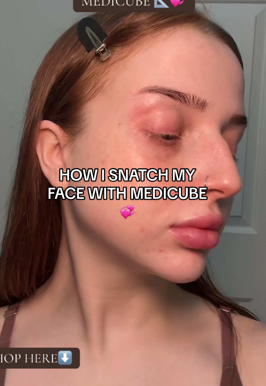 insaneee🫡💞 @medicube global @medicube US Store @medicube_us #medicubeskincare #medicubedevice #medicubeboosterpro #tiktokgemscontest #creatorsearchinsights 