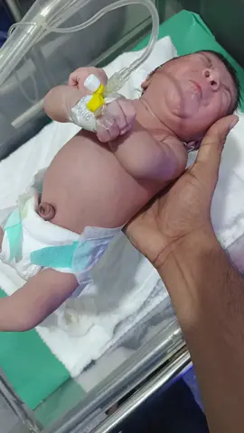 الكزاز الوليدي ... neonatal tetanus 