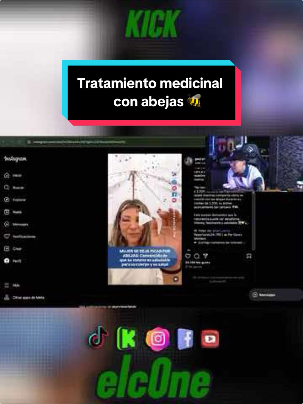 Mujer en Turquia es tratada medicinalmente con abejas #elc0ne #colombia #kick #abejas