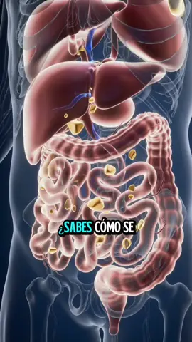 Así eliminan las piedras de la vesícula sin cirugía abierta #Salud #CuerpoHumano #Medicina #Ciencia 