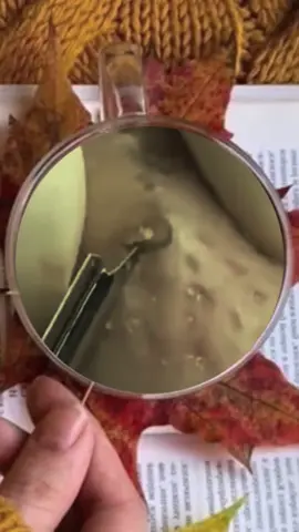 ##foryou #satisfying #squeezeyuk #pimplepop #acne 