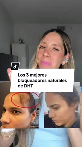 ¿Sabías que aunque logres hacer crecer nuevo cabello, si no bloqueas la DHT… ese pelo se vuelve a caer? 😱 La DHT es la hormona que miniaturiza tus folículos y acelera la caída capilar. Por eso necesitas bloqueadores naturales + un buen estimulante. 👉 Mis 3 favoritos con respaldo científico: ✔️ Cafeína ✔️ Melatonina ✔️ Saw Palmetto Lo mejor: con la línea IR Clinical tienes ambos en una sola fórmula (bloqueadores + estimulantes), y si lo combinas con el aceite Rejuveniqe, potencias aún más los resultados. 💪✨ Tip extra: yo incluyo un suplemento a base de saw palmetto 🙂 💬 Si necesitas ayuda con la caída de tu cabello, ve ahora mismo al cuestionario en mi perfil y te guiaré con tu rutina personalizada. #creatorsearchinsights #hairlosssolutions #caidadelcabello #dhtblocker #bloqueadoresdedht 