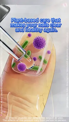 If you're also experiencing this situation, you can try this method! #nailcare #fallfreshness #nails #tiktokshop #glowupjourney