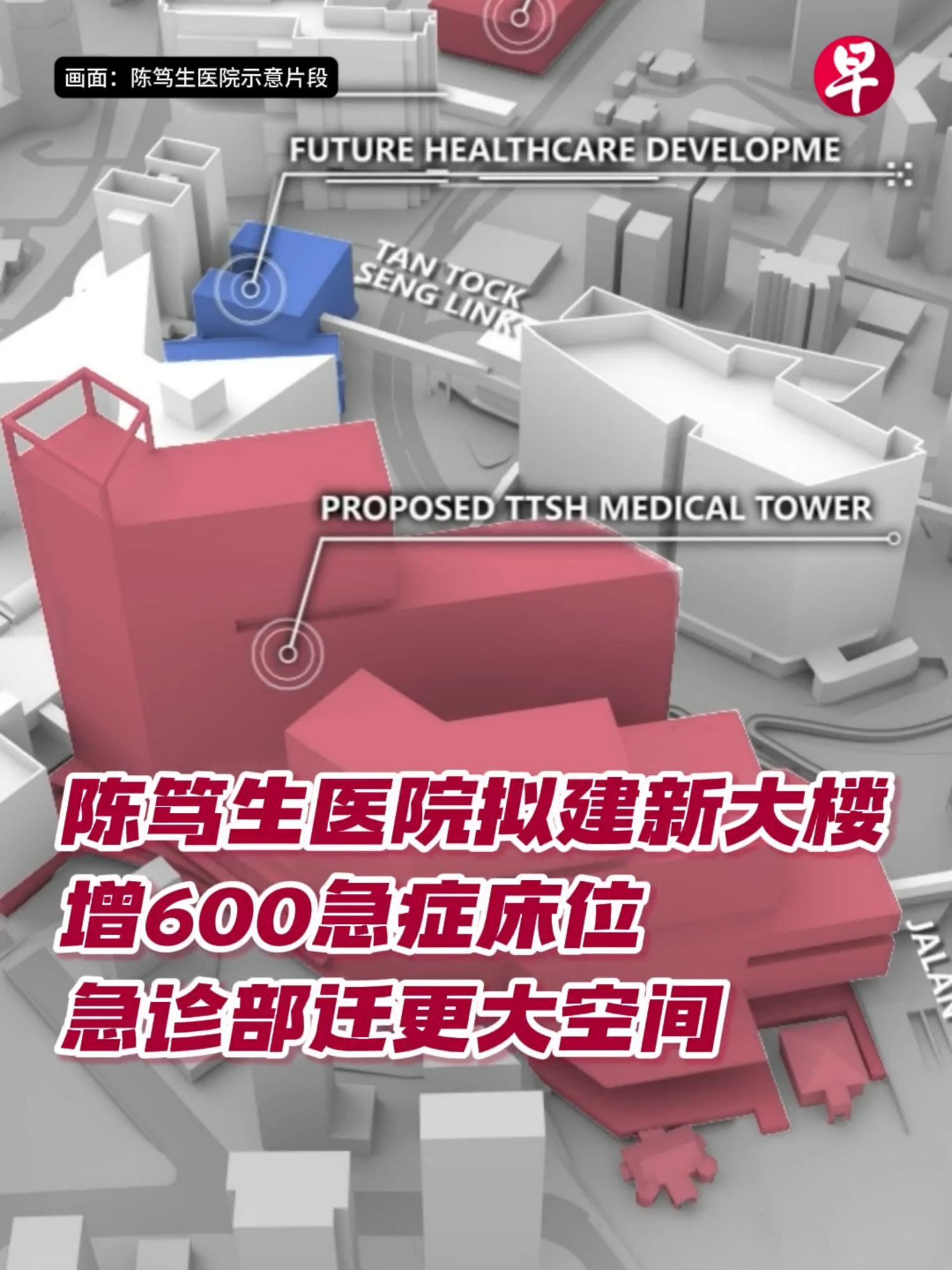 医疗蓝图再升级！陈笃生医院拟建新大楼，并预计在2030年之后落成。届时，大楼将增设600个急症床位与更多专科门诊，并引入新科技，改善病患就医体验。🎬：曾嘉琪 #zaobaosg #sgnews #singapore #singaporean #livinginsg #sglife #sghospital #tantocksenghospital #TTSH #MinistryofHealth #MOH #OngYeKung #viralsingapore #viralvideos #trendingsingapore #trendingvideos #新加坡 #新加坡新闻 #新加坡人 #新加坡生活 #新加坡医院 #陈笃生医院 #卫生部 #部长 #王乙康