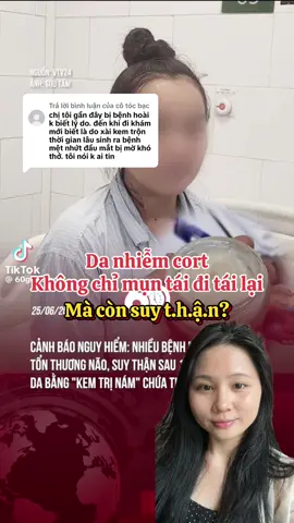 Trả lời @cô tóc bạc Chuẩn luôn bạn ơi. Da nhiễm cort mụn tái đi tái lại đã đành, còn rất nhiều tác dụng phụ khác nữa, có cả ngộ độc và suy thận. #munviem #danhiemcorticoid #chamsocda #goclamdep #suythan 