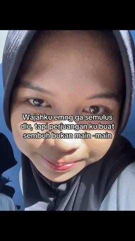 #pejuangjerawat #acnefighter 