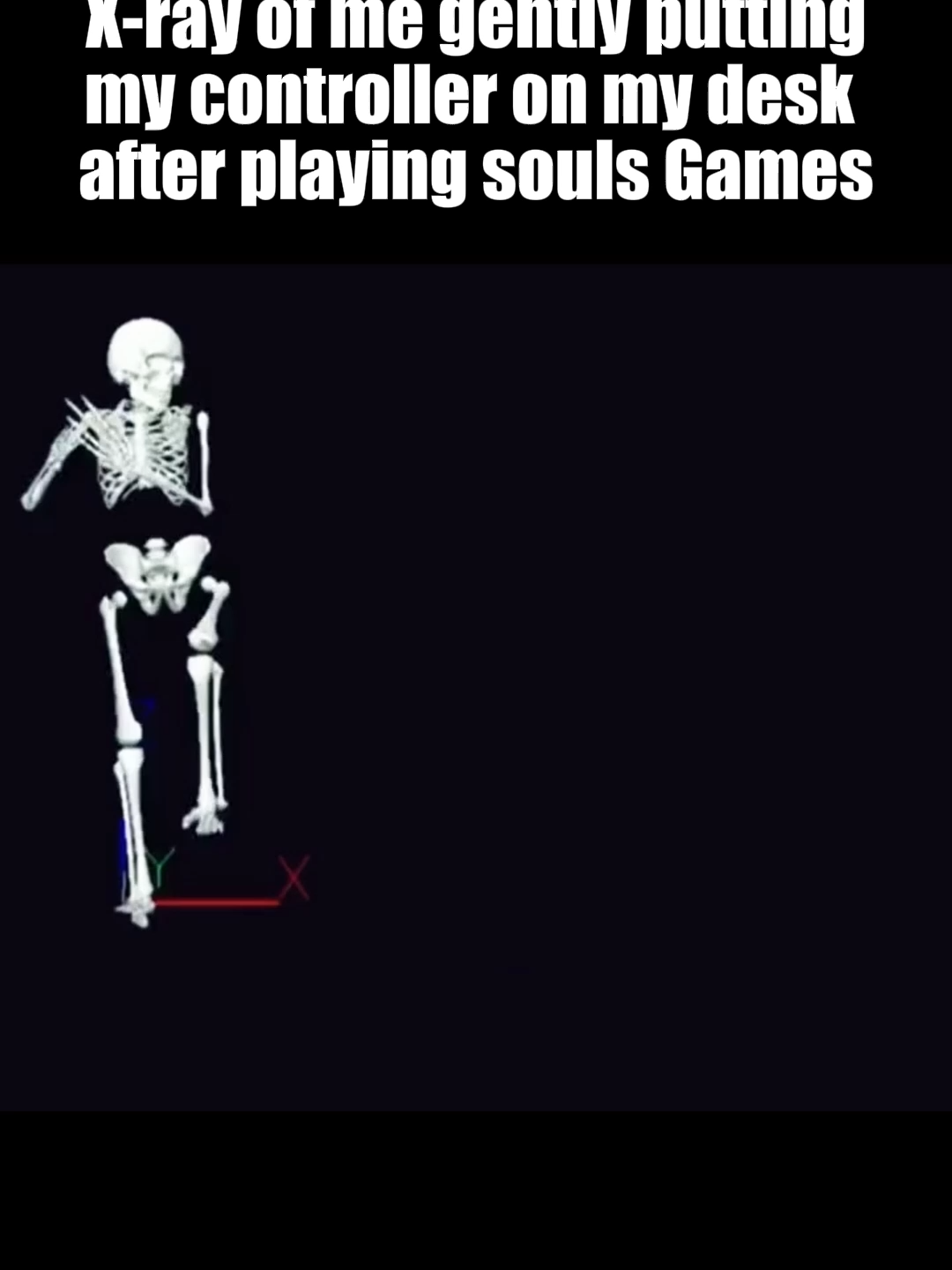 Anyone got a Controller to borrow 💀 #eldenring #darksouls