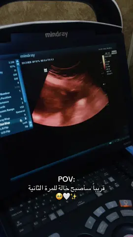 خالة للمرة الثانية 🥹#CapCut #explor #foryoupage #fypシ゚ #مالي_خلق_احط_هاشتاقات🦦 