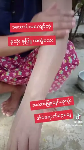 #ရှယ်ဖြူမယ် #အသားဖြူချင်သူများအတွက် 