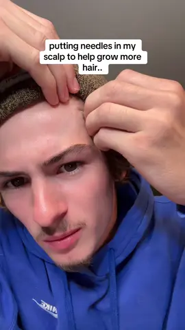 don’t do that #hairgrowth #hairthinning #hairloss #balding #bebodywise 