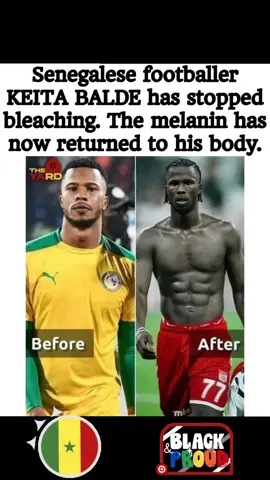 Black n Proud. no need for that row bish. God made you sexy, why you bleaching 🥲 #blackandproud  #senegalaise_tik_tok  #keitabaldediao  #casamance  #kolda 