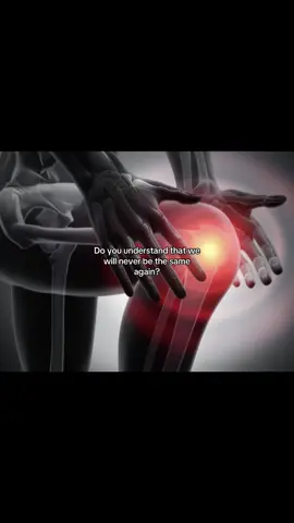 #kneepain #viral #fyp #trends #doyouunderstand 