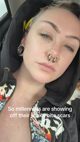 #millenial #snakebites #battlescars #scenekid #piercings