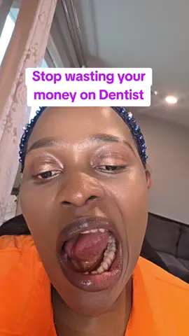 I stopped going to dentist after using this tooth armor#tootharmor #dentite #tiktokshopfinds #homefinds #giftideas 