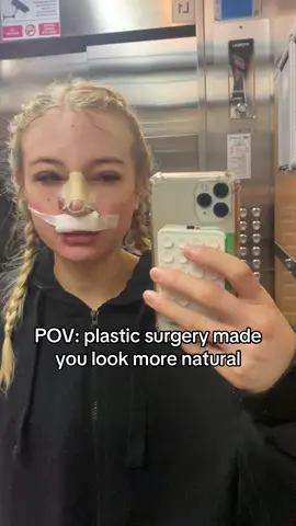 Im sure there’ll be some debate in the comments lol x #nosejob #rhinoplasty #rhinoplastie #nosejobturkey #nosejobcheck #rhinoplastyturkey #nosejobtransformation 