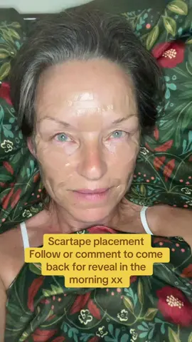 #Scartape #siliconescarsheets #scarsheets #wrinkles #beautyhacks 