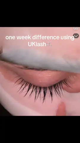 i can’t believe how long they are getting #fyp #lashserum #uklash #eyelash 