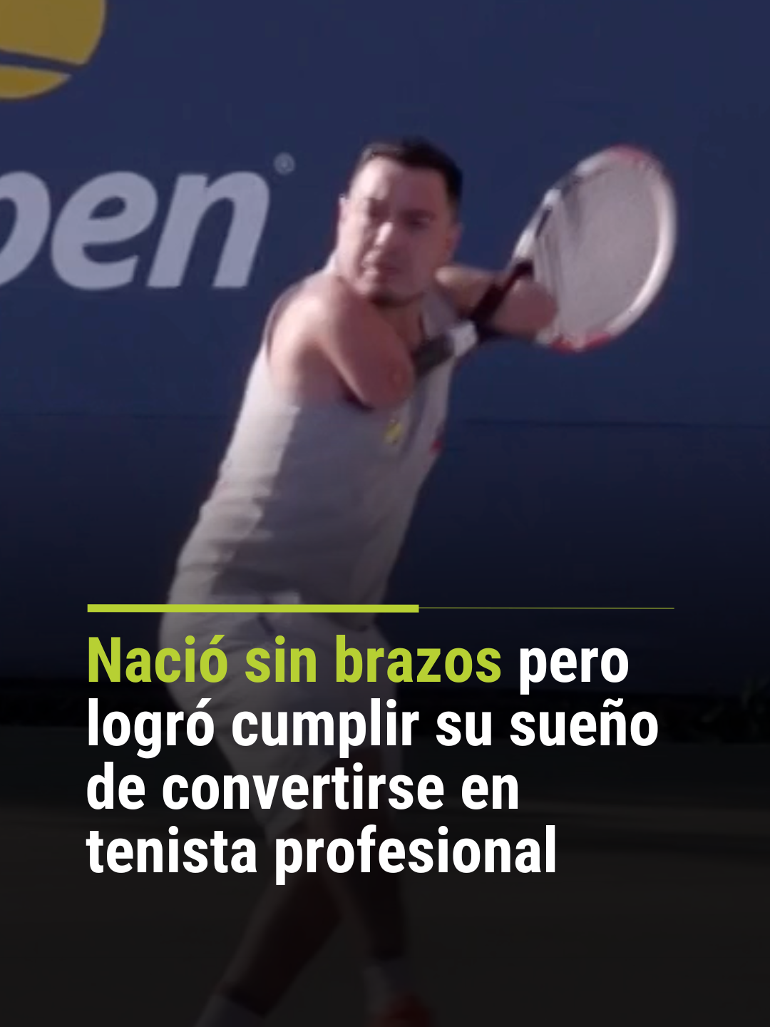 🎾 Nació sin brazos pero logró cumplir su sueño de convertirse en tenista profesional. Nicolás Basáez es un joven chileno de 34 años que nació sin brazos debido a una malformación congénita. Eso no impidió que, desde pequeño, mostrara una gran aptitud para los deportes. Fue a los siete años que conoció el tenis, el deporte que marcó su vida. Actualmente ocupa el primer lugar de Chile y octavo en el mundo de categoría Para-Standing, una modalidad para jugadores con discapacidad física.  Esta es su impactante historia. 📺 No te pierdas Primer Impacto de lunes a viernes a las 5pm/4C por @univision. #Tenis #PrimerImpacto