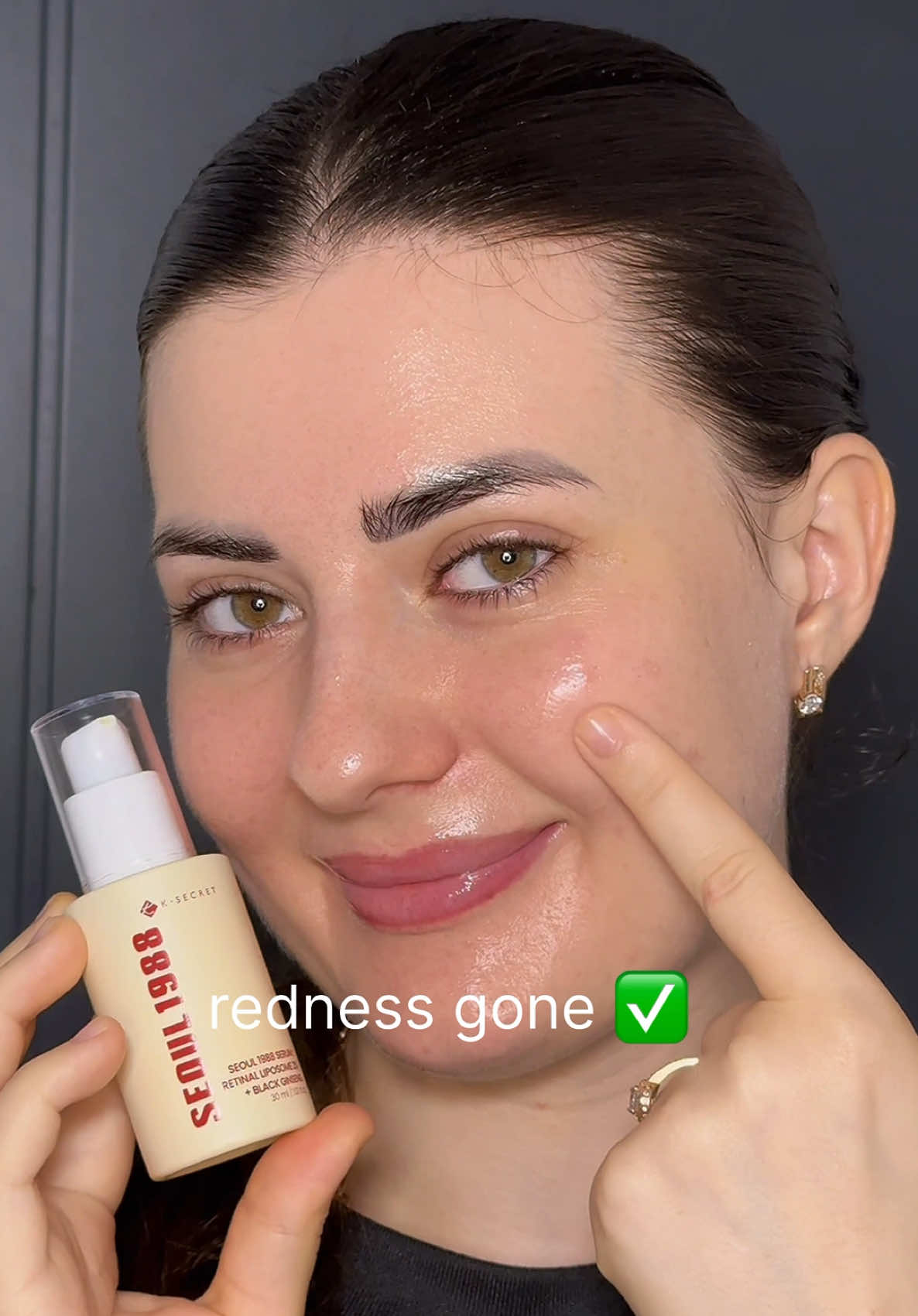✨ With the K-Secret Seoul 1988 Serum: Retinal Liposome 2% + Black Ginseng, my breakout faded in just 7 days — soothing, brightening, and restoring my skin’s glow! 💧🌸@KSECRET GLOBAL 	#KSECRETGlowChallenge #KSECRET #Seoul1988 #Retinal #acnetreatment 